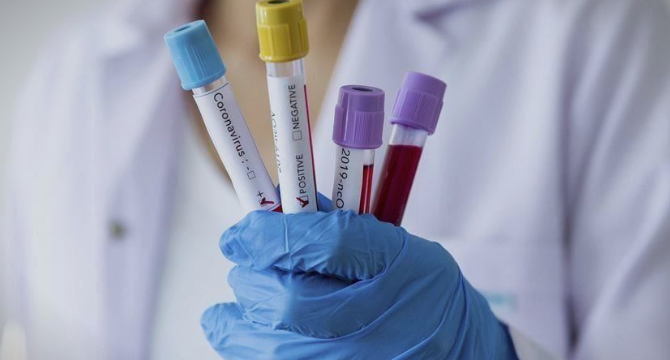 Николов: ВМРО-ДПМНЕ бара зголемување на бројот на тестови, само така ќе знаеме на што сме и како треба да се дејствува