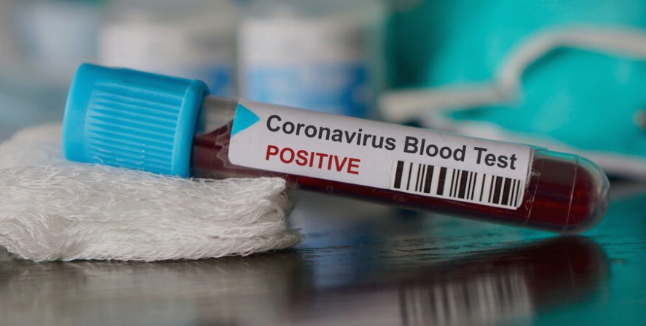 Коронавирус: 384 заболени во Македонија, повеќе од половината во Скопје