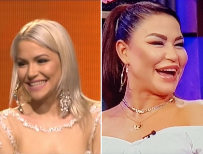 Беше слатка девојка, а потоа се деформираше: Александра претера со операциите, а тврди дека само се здебелила (ФОТО)