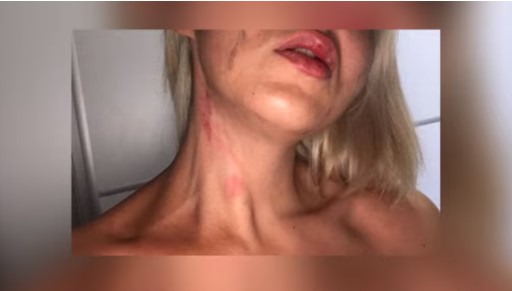 Велешанката Моника доживеала голгота на автопатот Скопје- Велес